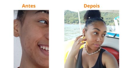 Resenha Hidratante Cerave para pele oleosa e acneica