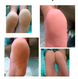 curso plástica dos pés online com certificado