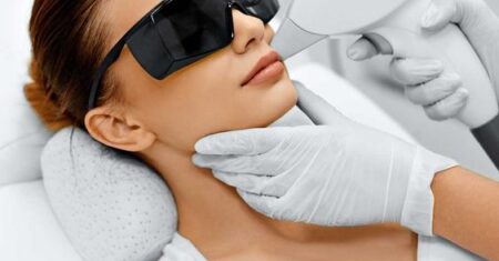 Depilação a laser no buço: Cuidados, Resultados, Procedimento