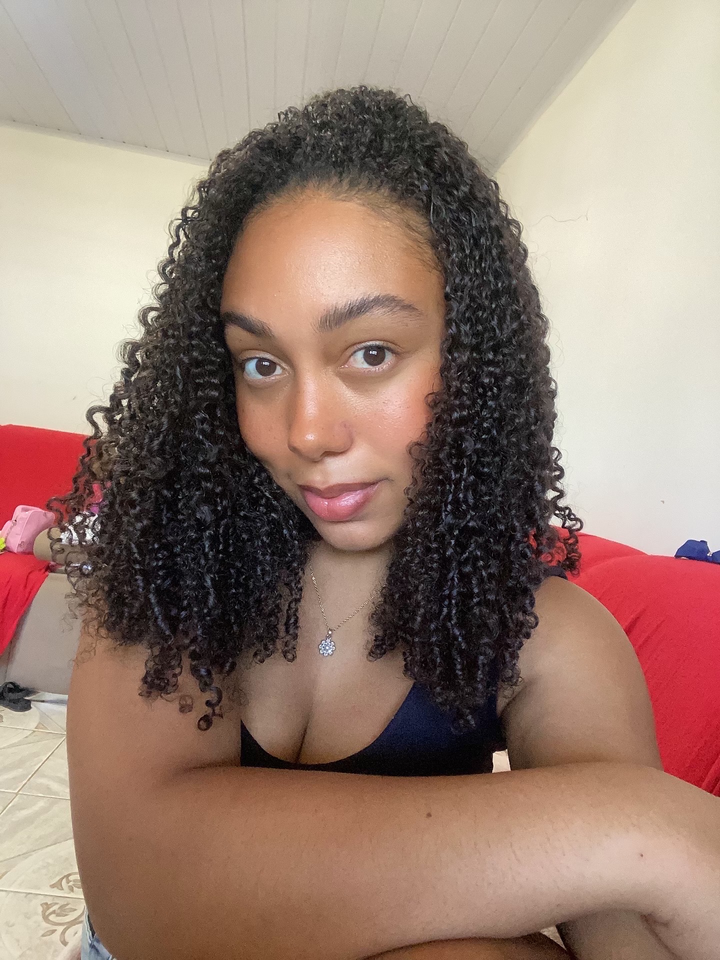 Porosidade capilar, como acabar com a porosidade capilar, Samara Magda